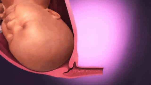 顺产一般几天开始拉粑粑,顺产时拉大便了医生会帮忙洗吗