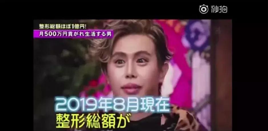 刘梓晨到底有没有整容啊,还记得整容界网红刘梓晨吗