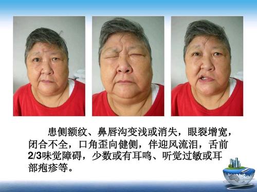 灏忎腑椋庝腑鍖昏兘鏍规不濂藉悧,涓尰娌绘剤浜嗗皬涓