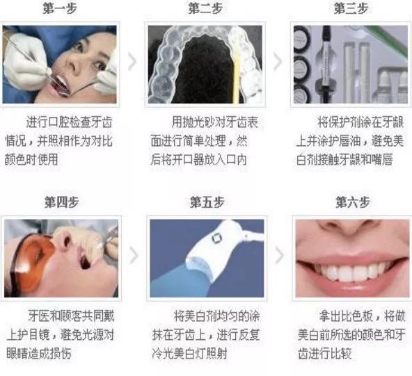 美白去黄牙齿牙膏推荐,牙齿祛黄美白用什么产品比较好