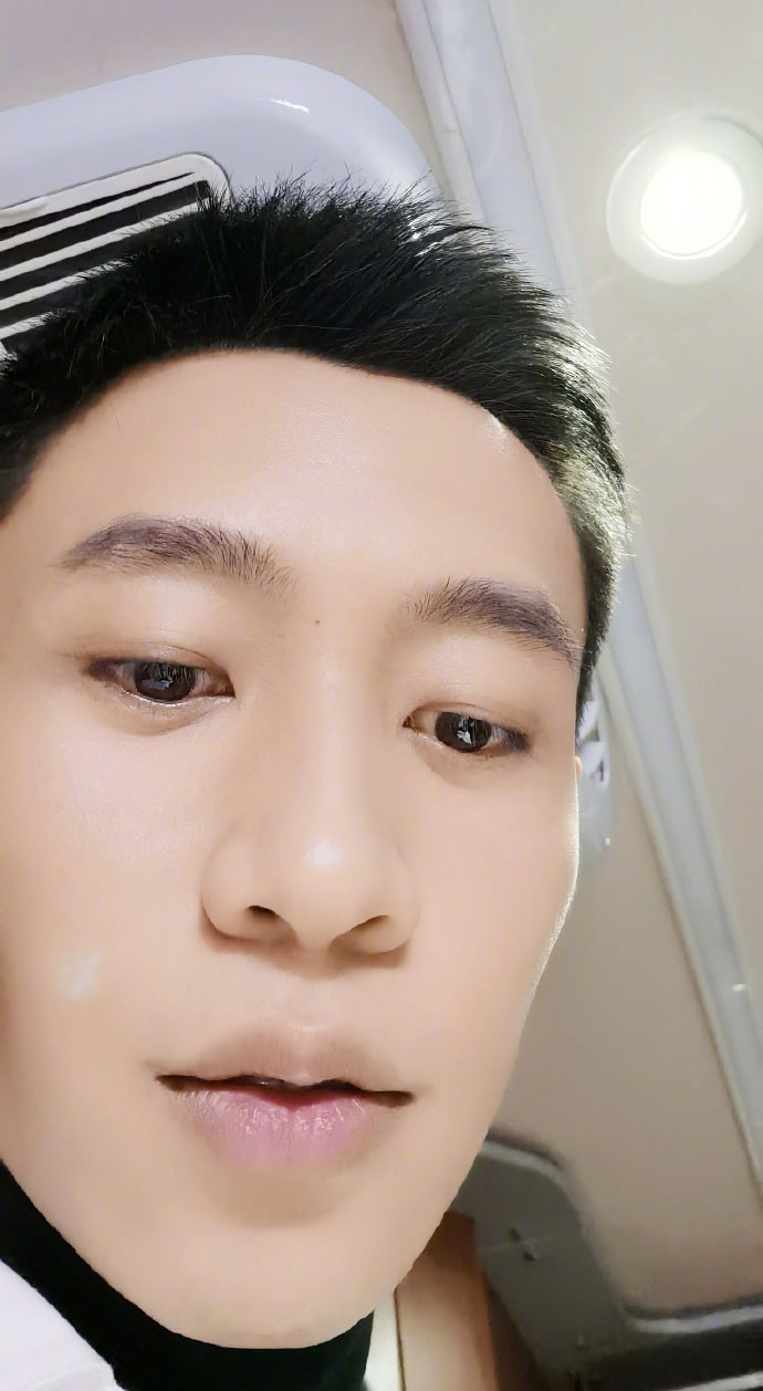 俞灏明的脸能修复吗,俞灏明的脸怎么修复的