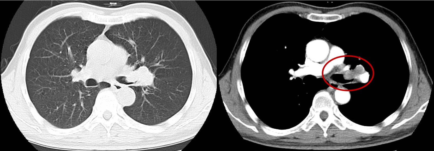 抗癌药物选择,如何选择抗癌药