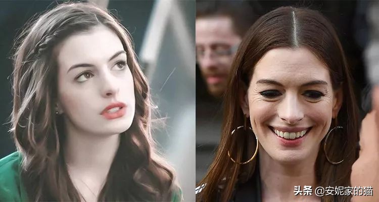 法令纹怎么解决最显老,法令纹显老10岁三种方法帮助改善