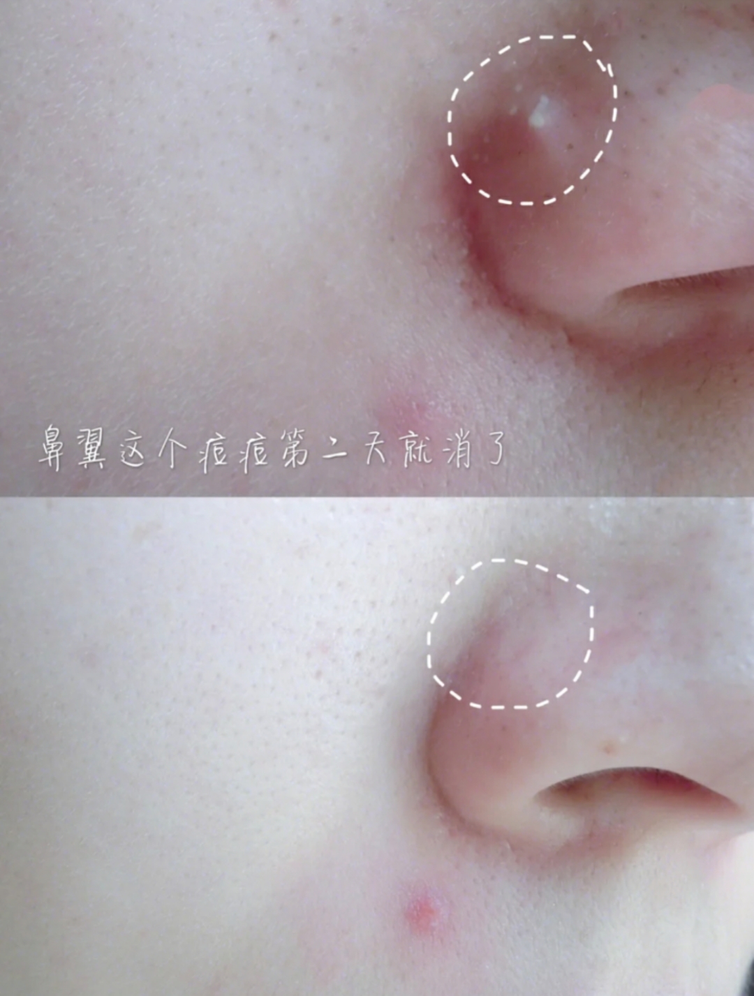 美容仪的真实效果,美容仪最实用的功能