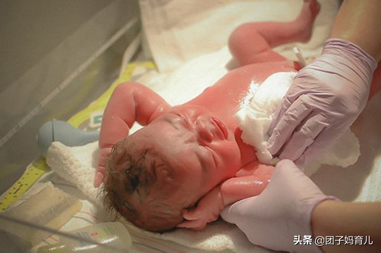 新生婴儿假性例假,新生儿来月经的症状