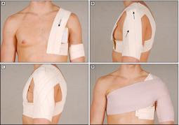 武磊肩伤到底做不做手术,武磊肩伤到底是多重