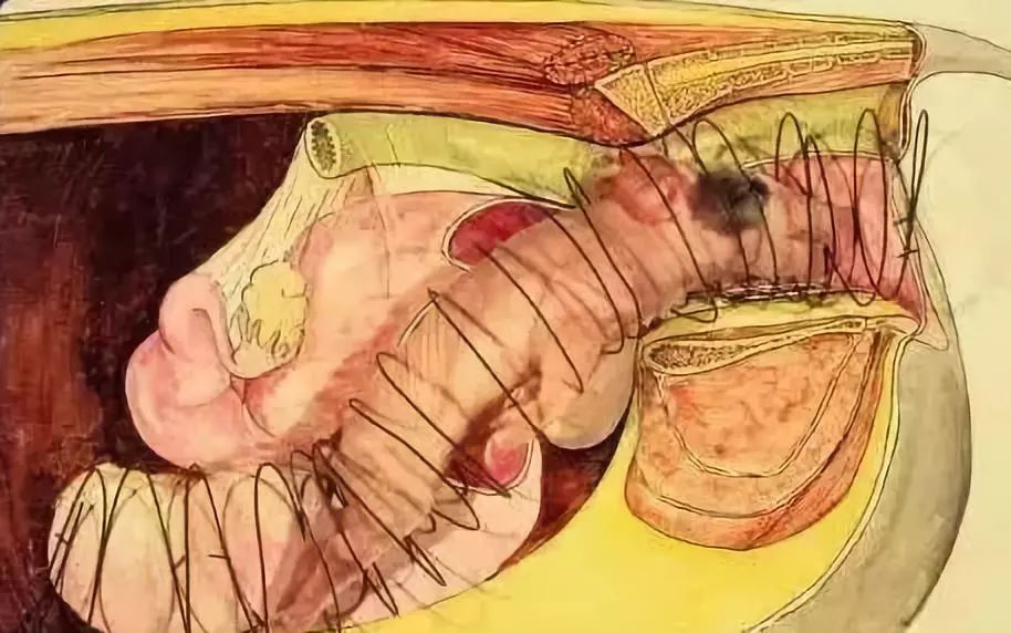 母猪难产掏小猪示范教程,怎样掏难产的母猪