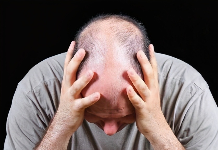 秃如其来中年危机,秃如其来原因