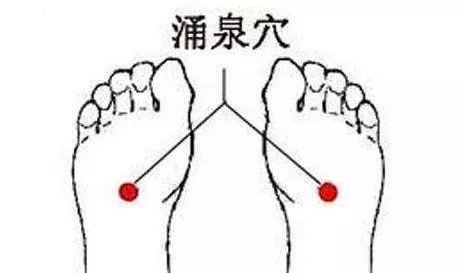 脚后跟干裂小腿皮肤干裂咋回事,脚后跟角质干裂图片