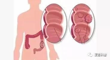 没拉出大便但有血是怎么回事,拉出的大便带血怎么回事