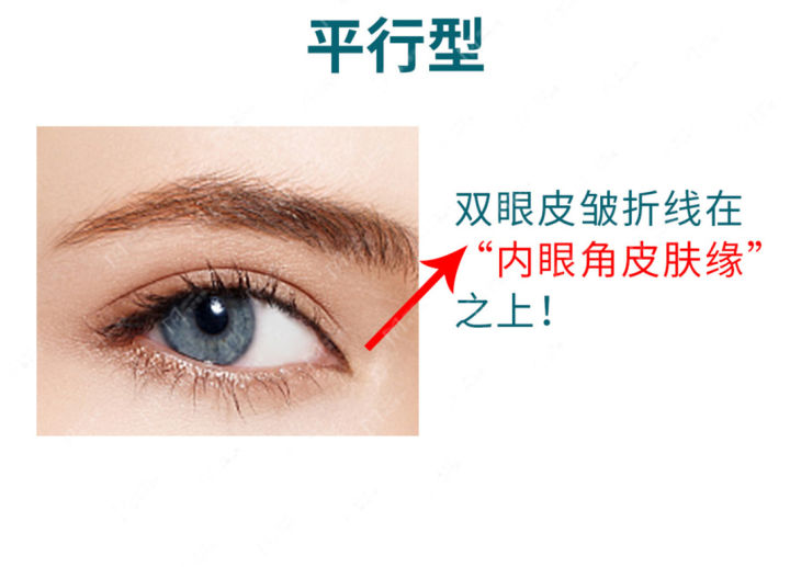 最好看的四种双眼皮内双,三种双眼皮哪种效果好
