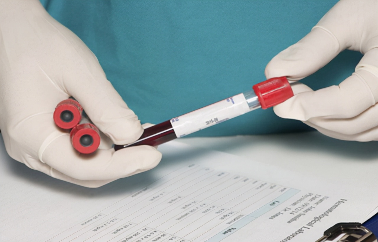 a型b型o型ab型哪种血型的人更长寿,a型b型o型哪个血型身体素质好