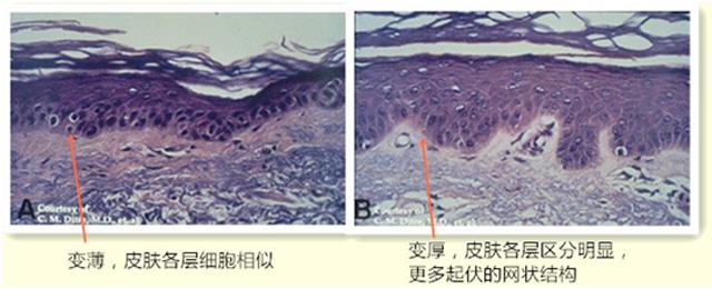 科普为什么果酸能美白皮肤,果酸换肤的正确使用方法
