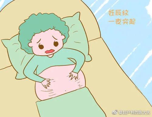 「今日陈大夫营业之」如何减少妊娠纹？
