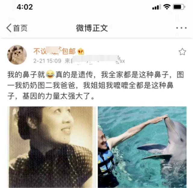 网红代王被质疑整容，晒奶奶爸爸照片自证没整鼻子，曾承认做填充