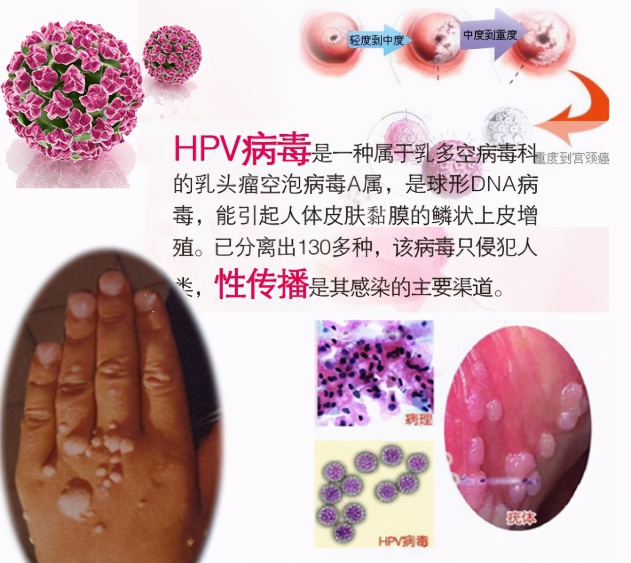 “难以启齿”的肛门癌，你了解他吗？出现这3个症状，或许不妙