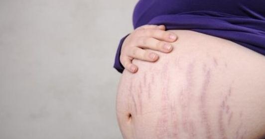 辣妈快速瘦肚子法,辣妈瘦肚腩的最快方法三个动作