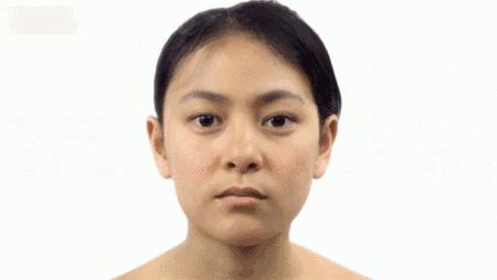 改善皮肤松弛下垂最有效方法,皮肤下垂显老态如何拯救