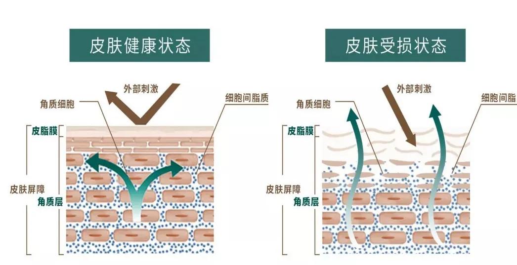 女孩子烂脸是什么原因,烂脸怎么修复女生