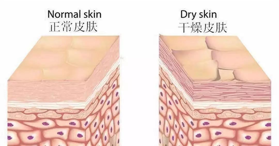 大干皮用的身体乳推荐,女生干皮冬季身体乳推荐