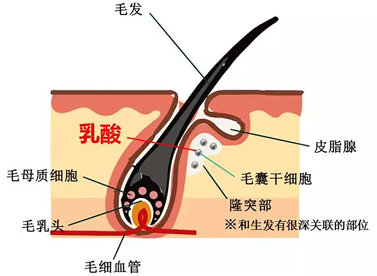 含铂化疗引起脱发,化疗导致的脱发怎么治