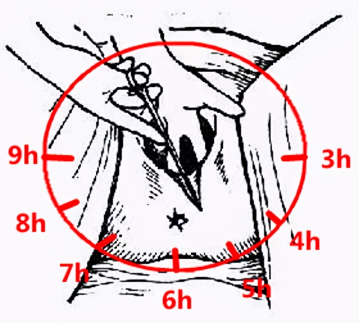 自然顺产会有哪些后遗症,顺产会留下多少后遗症