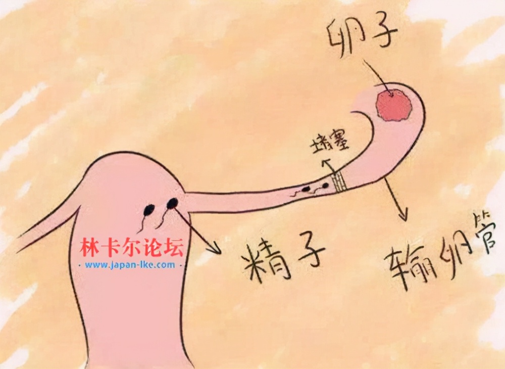 妇科炎症吃什么药不会反复复发,妇科炎症复发4种食物要少吃