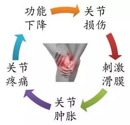 膝关节滑膜炎怎么办好得快,膝关节得了滑膜炎应该怎样恢复