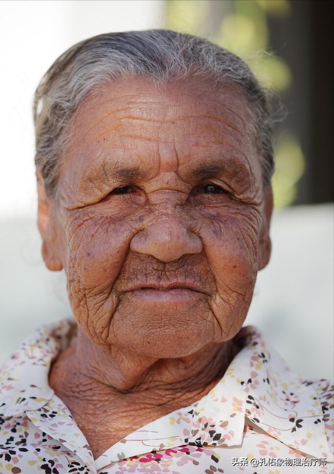 年轻人去除老年斑最有效的方法,老年斑怎么去除几大妙招抢先看