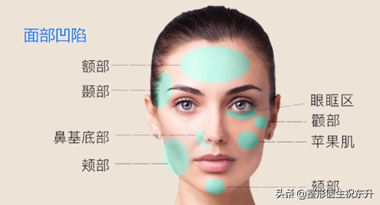 面部凹陷填充哪种方法最好,面部凹陷填充的方法有哪些