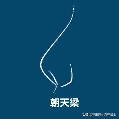 鼻整形如何一步到位,袁博整形医生