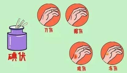 皮肤损伤，磕破和擦伤了，应该抹什么药，我来告诉你