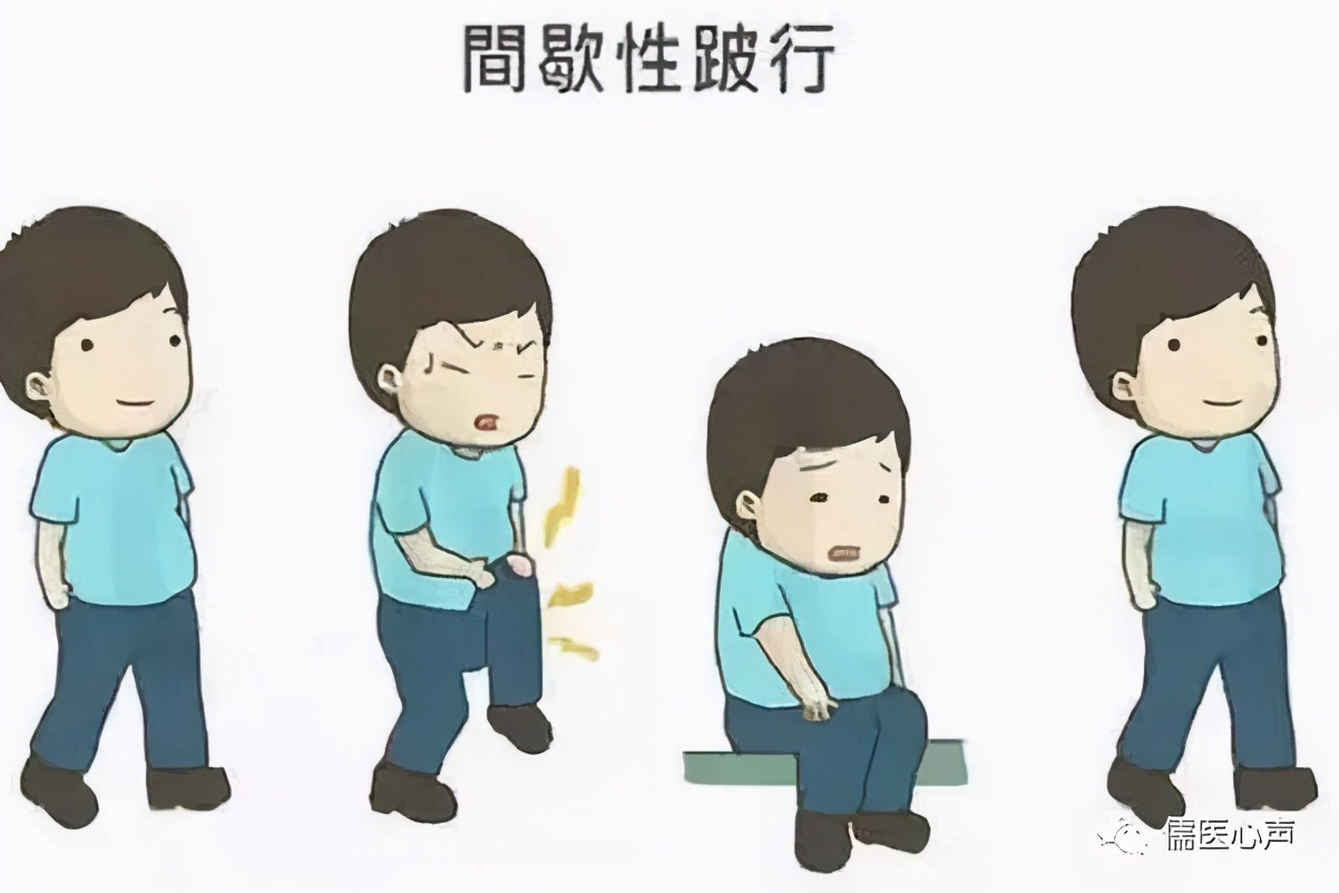 腰痛连带腰椎管狭窄怎么治,腰痛椎管狭窄怎么治疗