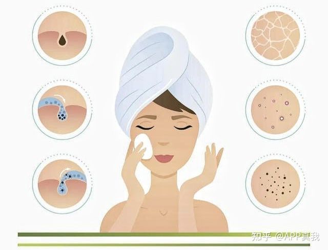 刷酸的作用效果持续多久,刷酸一次效果能维持多久