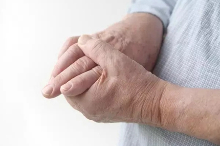 类风湿因子高关节不疼,类风湿因子高怎么样能降下来