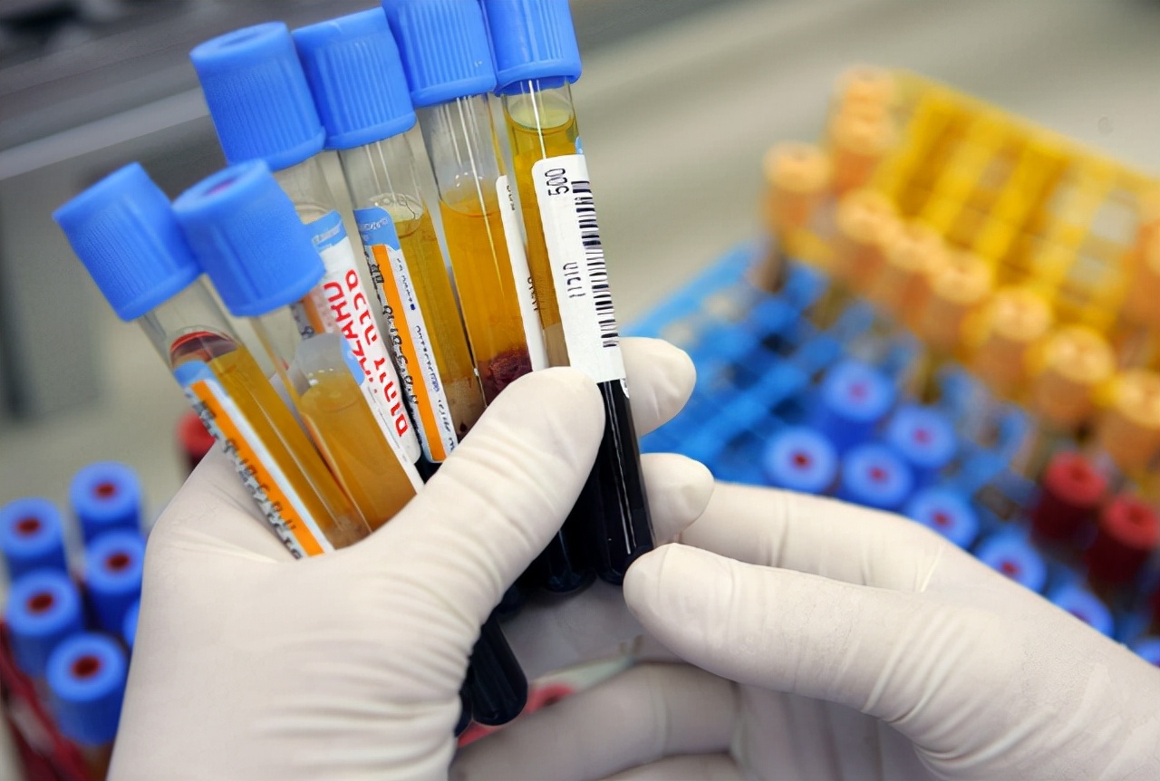 a型b型o型ab型哪种血型身体好,o型a型b型血型匹配