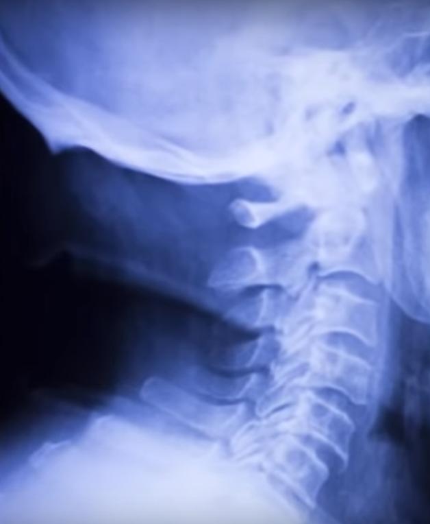 最厉害的摔角手,摔角十大死亡事件