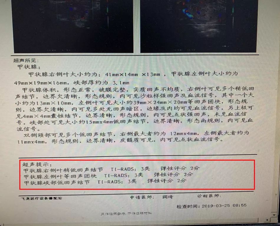 看懂化验单判断甲状腺结节良恶性,甲状腺结节微创和开刀的区别