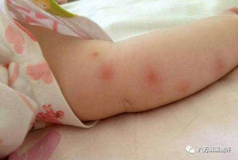 防蚊裤测评视频,辰辰妈防蚊裤测评