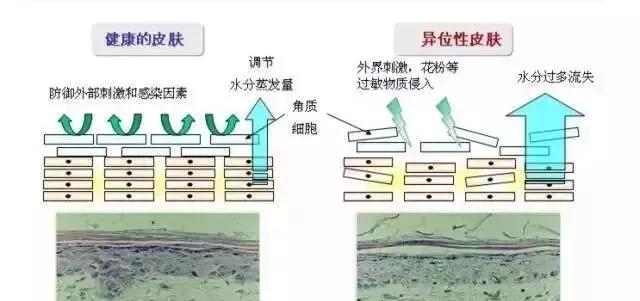 春敏后期全脸脱皮,过敏脸上起皮发痒