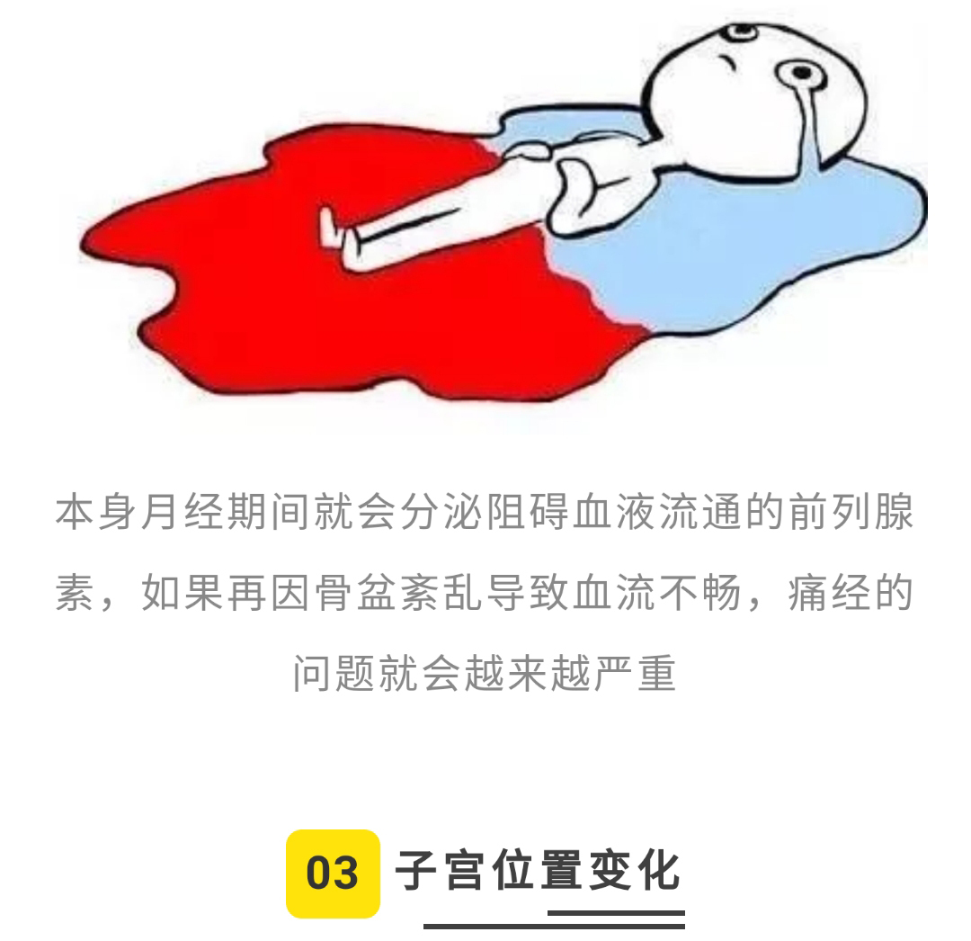 月经肚子疼腰痛,骨盆前倾为啥会月经紊乱
