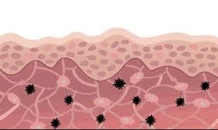 长斑的原因是先天还是后天,容易长斑的十件事