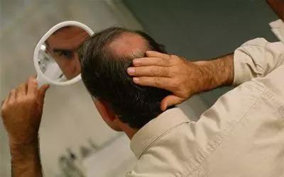 脱发能不能治好，要根据看你的脱发类型