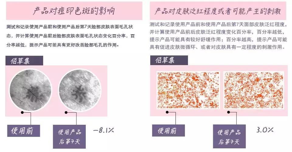去皱美白精华国货,100元国货美白精华推荐