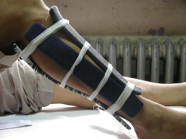 你知道伤筋动骨一百天,但不知道骨折要这样护理,恢复得又快又好