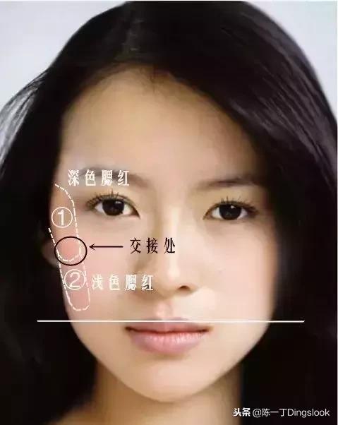 颧骨高太阳穴凹陷怎么改善脸型,颧骨宽大太阳穴凹陷快速改善