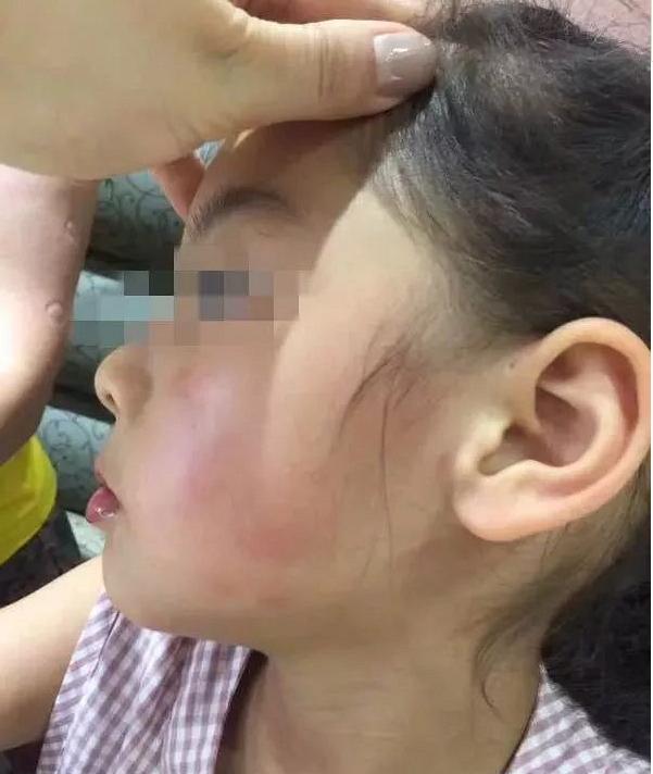 孩子幼儿园打架家长该不该介入,小孩子跟同学打架家长应该介入吗