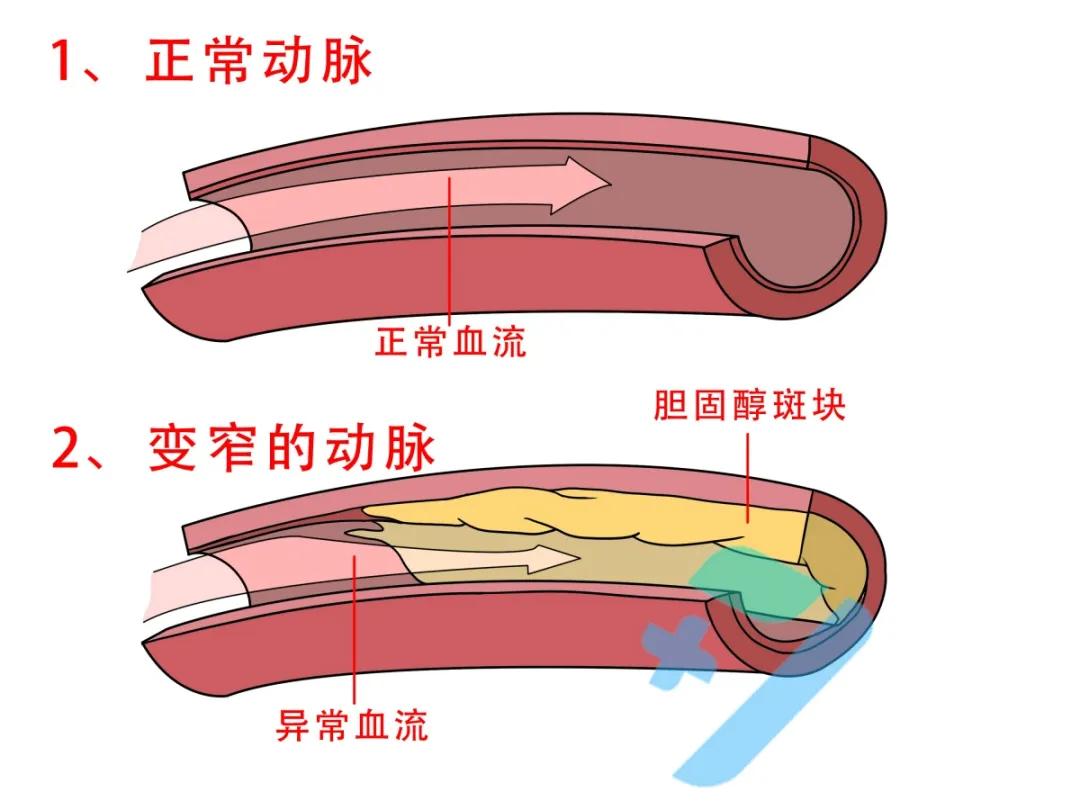 左眼跳财右眼跳灾到底可不可信,左眼跳财右眼跳灾是不是正确的