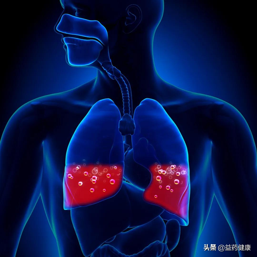 哮喘三联吸入新药,最新哮喘新药是什么