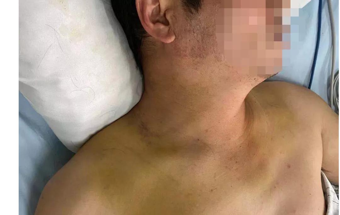 河科大一附院重症内科,河科大一附院康复治疗